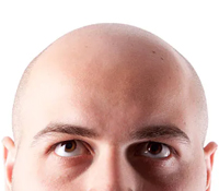 ESL Vocab - bald