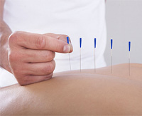 ESL Vocab - Acupuncture